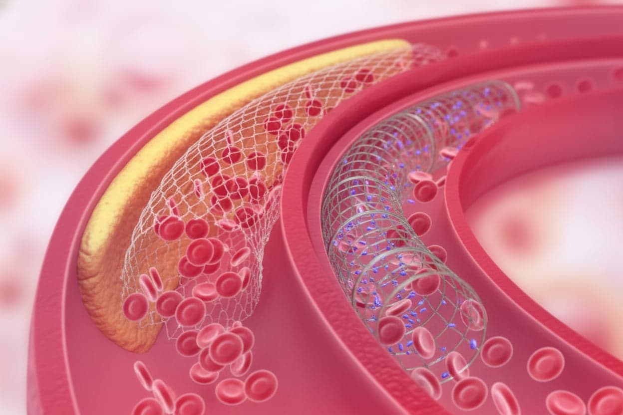 Behandeling van hypercholesterolemie